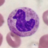curkholderia