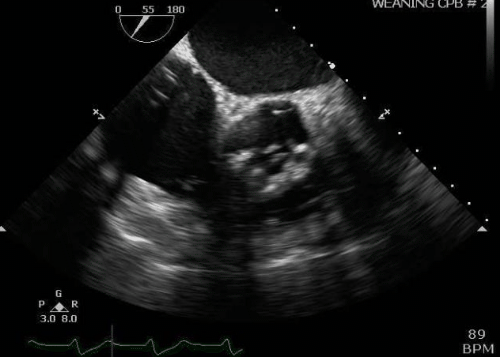 PmIH199.gif