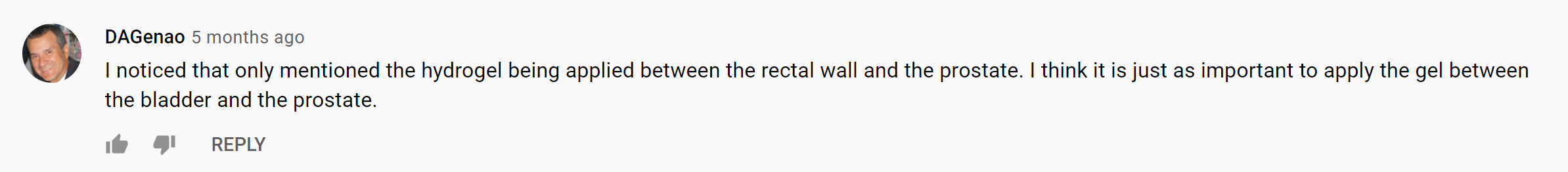 MdQgPJ0.png