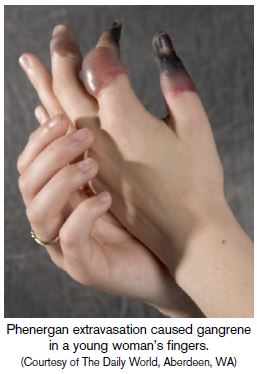20060810fig1.JPG