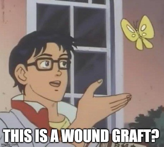 b1xpfe.jpg