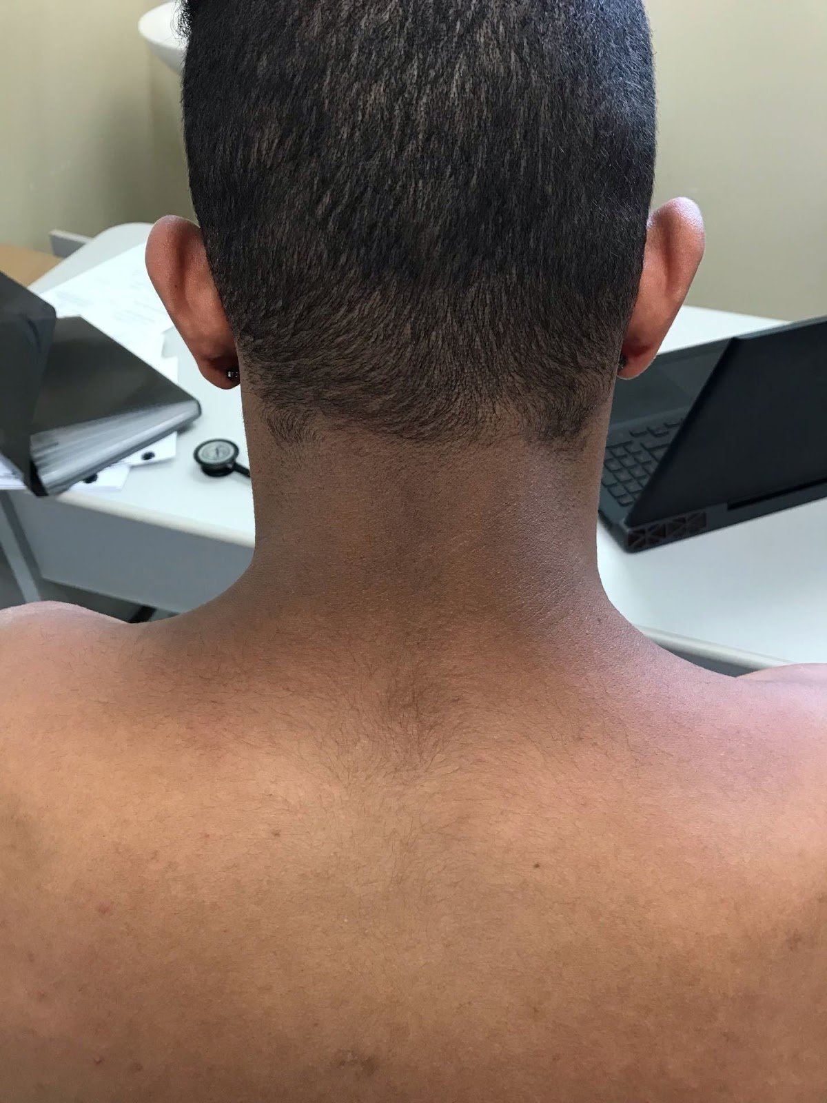 Neck_Rash.jpg