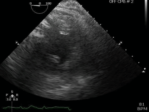 cd2aZB4.gif