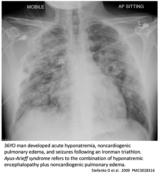 emcrit.org