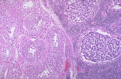 MALE096.jpg