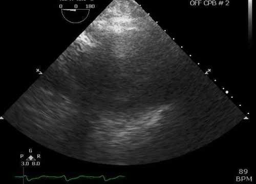 QW9PaC1.gif