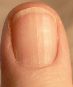 fingernail.jpg