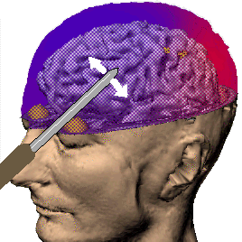 icepick.gif