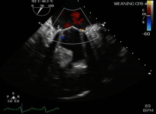 K3Qxo8v.gif