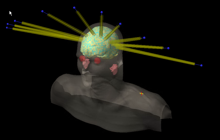 XH9PJ5z.png
