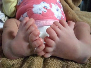 chinese+baby+with+16+toes+sixteen+toes+baby+from+china+2.jpg