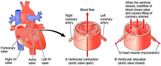 Opening%20of%20coronary%20arteries%20in%20the%20aortic%20valve%20(anterior%20view).jpg