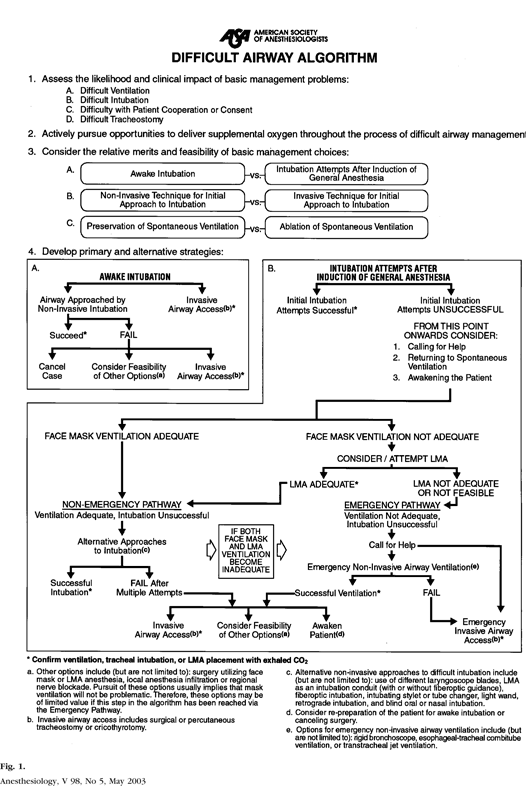 difficult_airway.gif