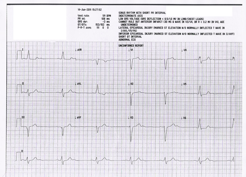 case-ecg.jpg