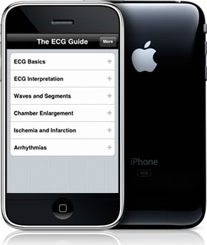 iphonewithecgguide.jpg