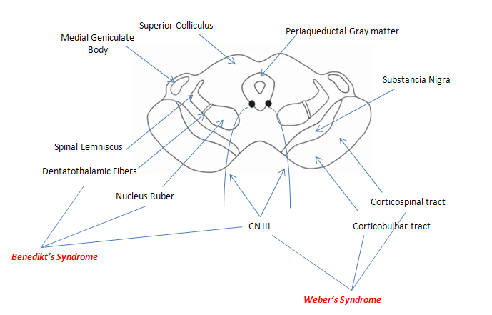 2857d1349449128-brainstem-dorsum-cross-section-lesion-brainstem-sections.png