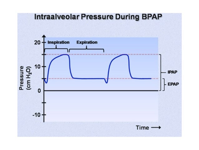 cpap-11-638.jpg