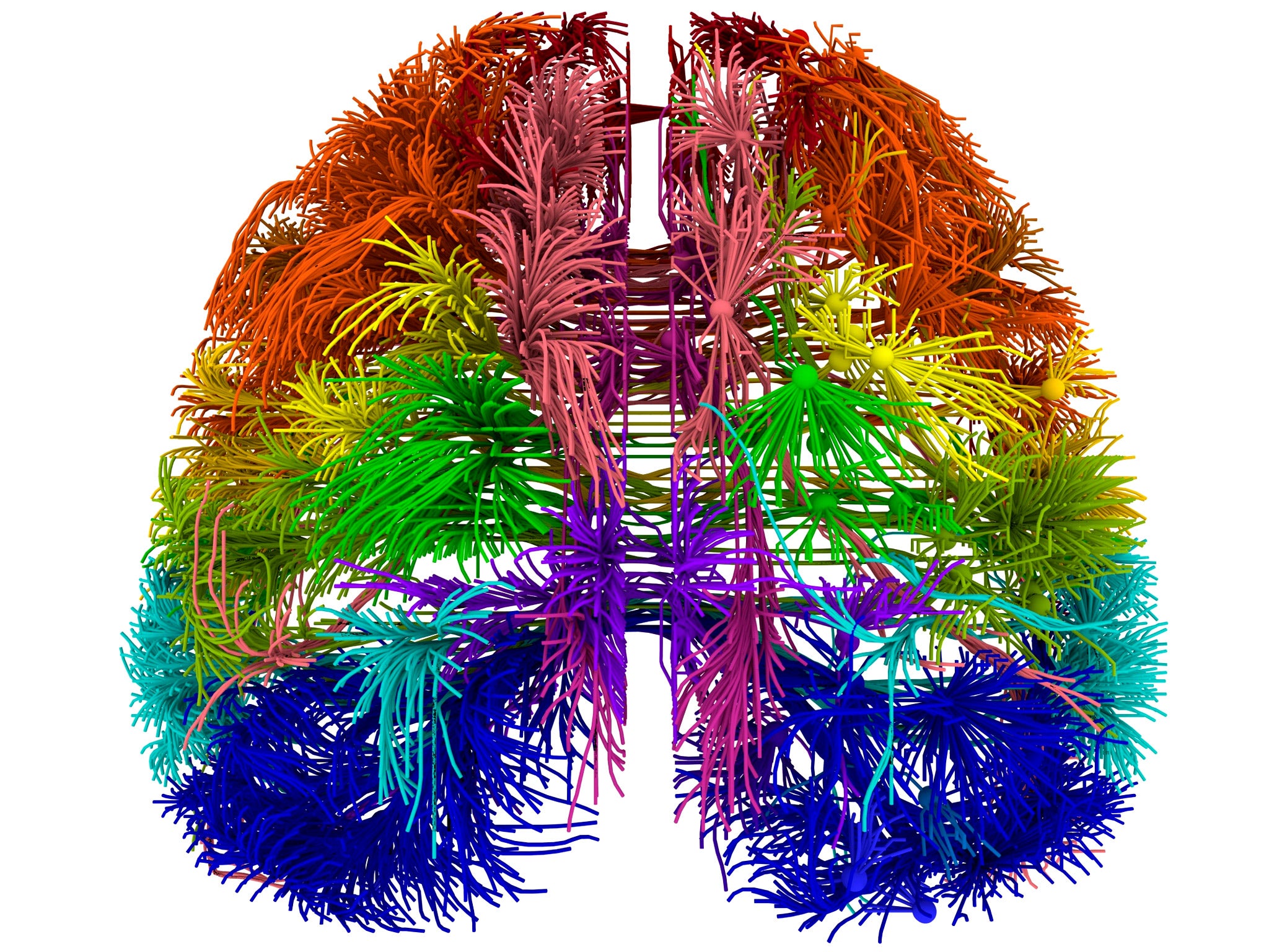 web-3d-brain.jpg
